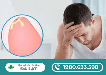 Hình ảnh minh họa